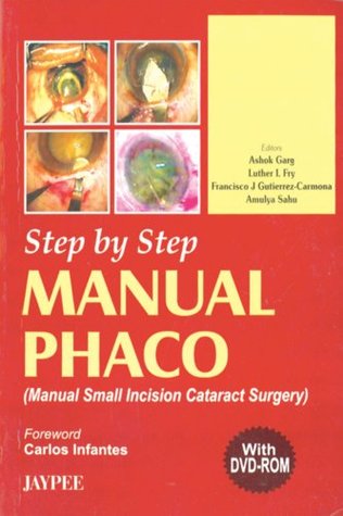 [61fe0] @R.e.a.d! ^O.n.l.i.n.e* Step by Step Manual Phaco with Interactive DVD-ROM - Garg @P.D.F%